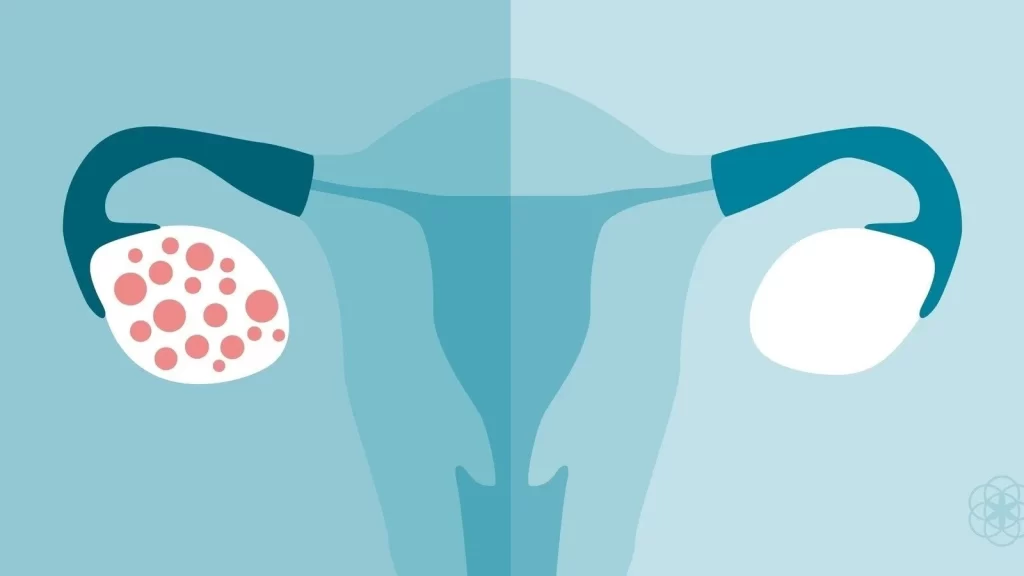 The PCOS Protocol: Achieving Hormonal Harmony Without the Guesswork 1 wellness blood test dubai